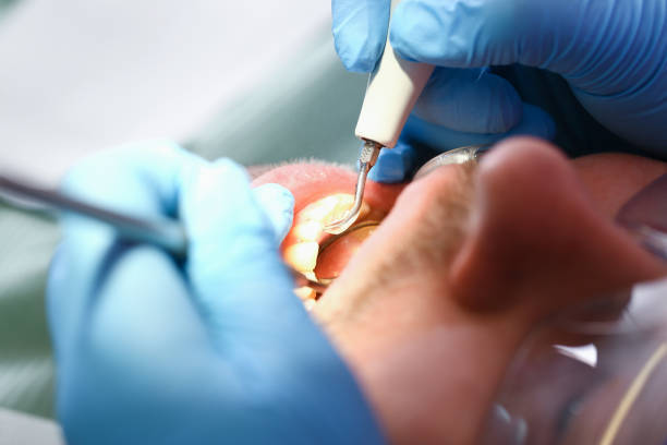 Best Same-Day Emergency Dentist in Llender, CA