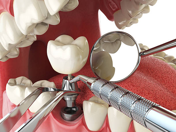 Best Same-Day Emergency Dentist in Llender, CA