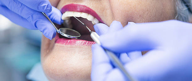 Best Emergency Tooth Extraction in Llender, CA